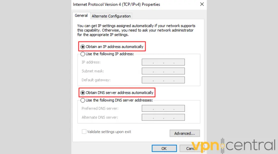 Obtain IP and DNS Addresses Automatically